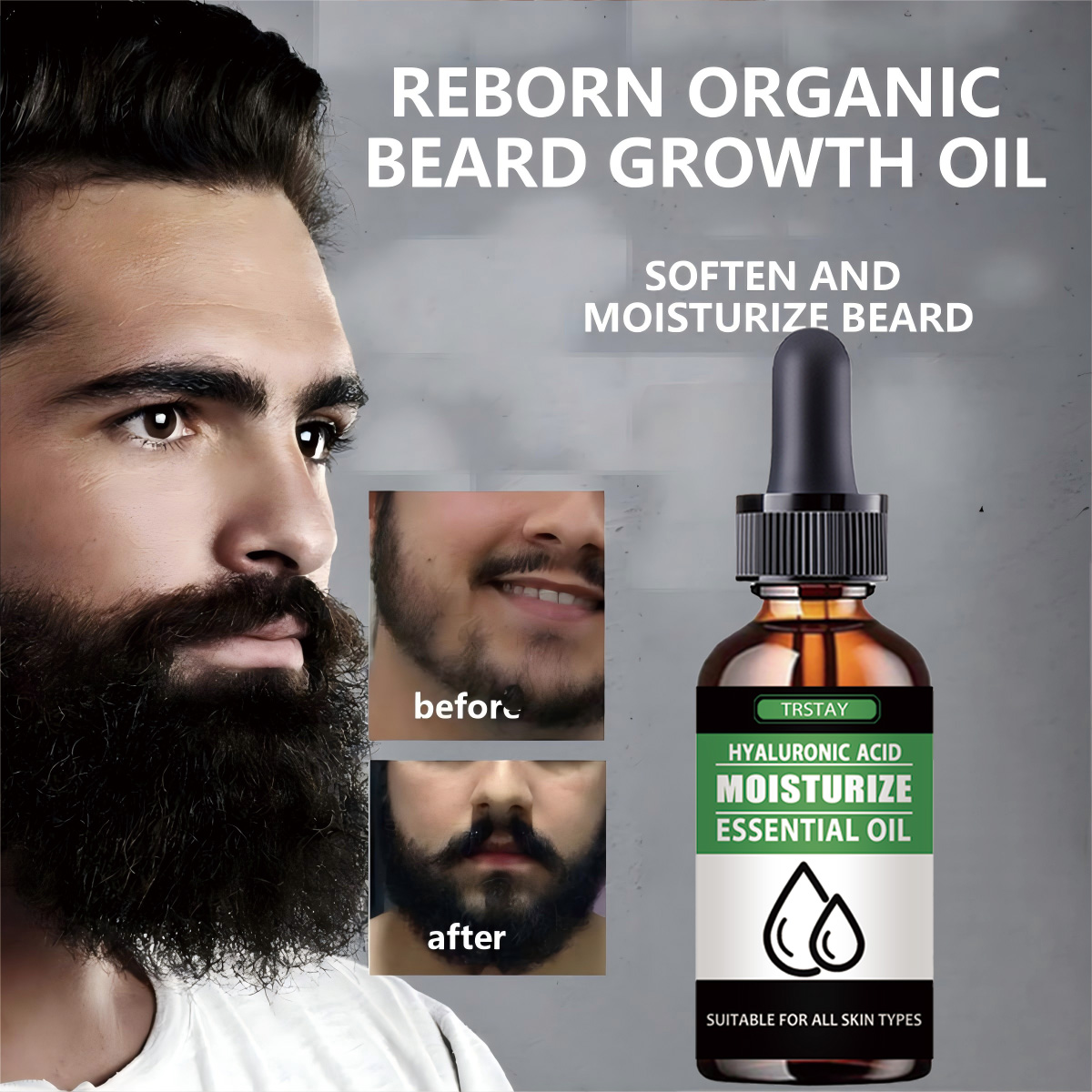 Hair Care Natural Products - 100% natural acelerar o cabelo facial