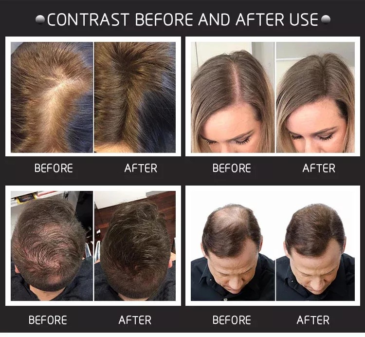 Fibras Capilares de 28g com Pu - Hair Care Natural Products avaliação e preço