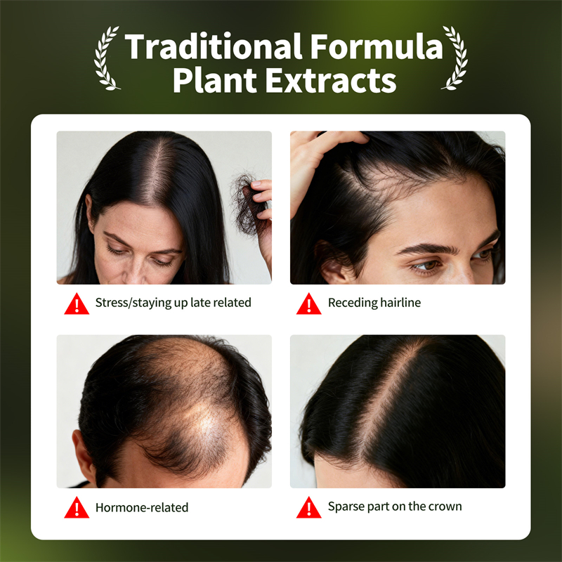 Conjunto de crescimento capila - Hair Care Natural Products avaliação e preço