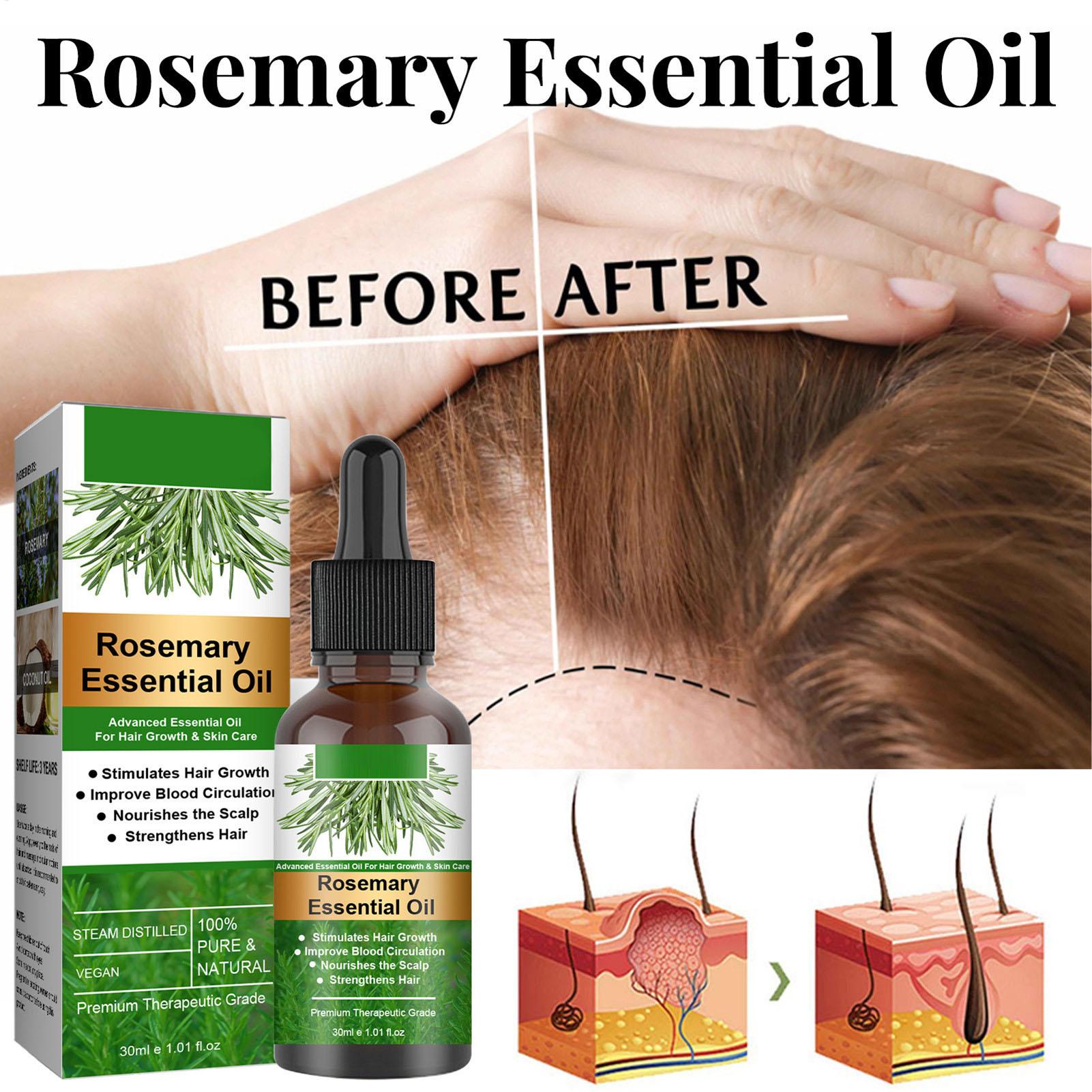 Óleo Essencial de Alecrim para - Hair Care Natural Products avaliação e preço